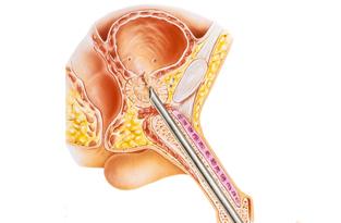 urologie.jpg